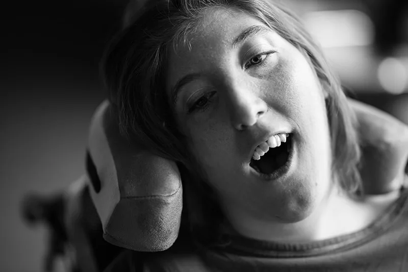 portrait-mas-handicap-regard-emotion-philippe-martz