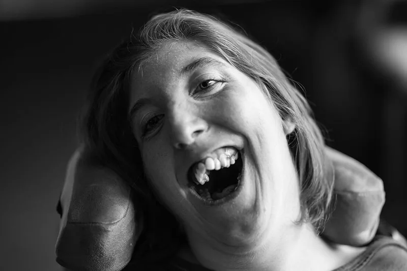 portrait-mas-handicap-regard-sourire-emotion-noir-et-blanc-philippe-martz